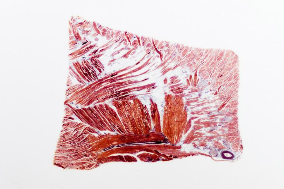 Free Image of skeletal muscle 