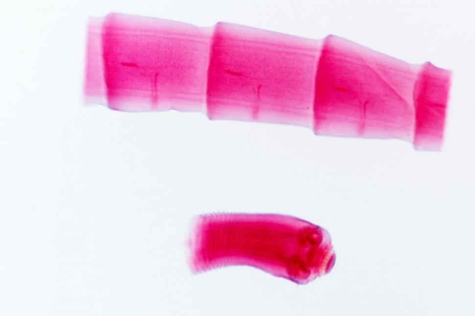 Free Image of tapeworm section 