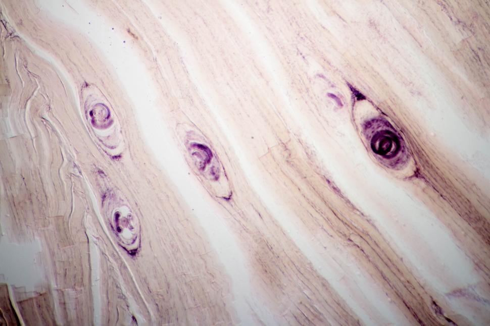 Free Image of Trichinosis 