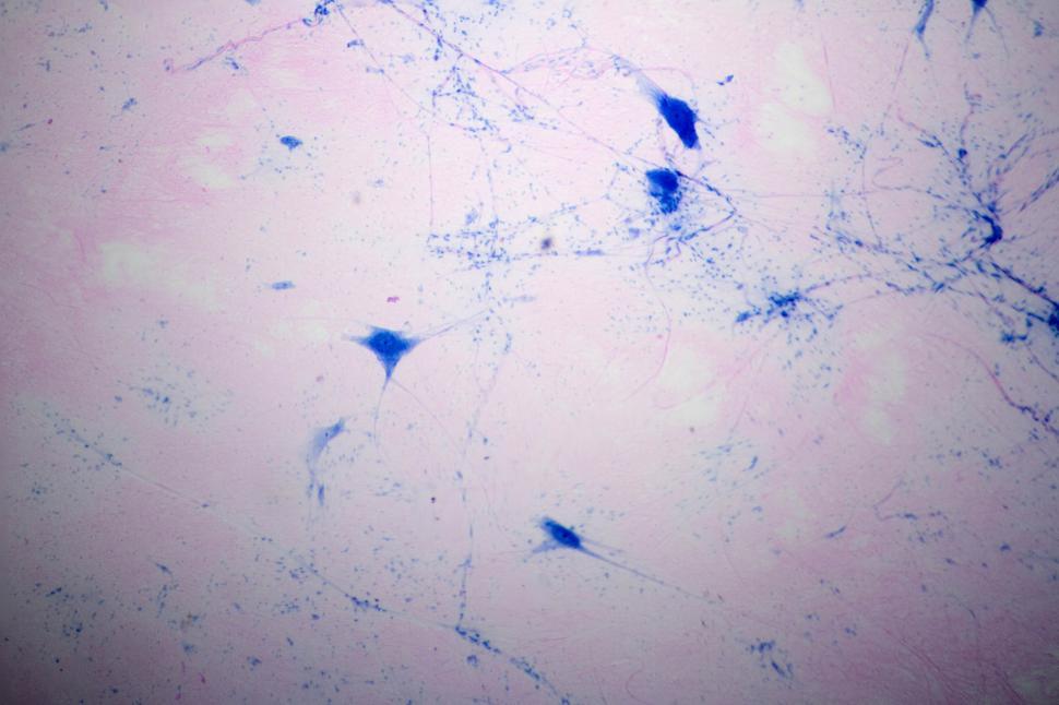 Free Image of Multipolar neuron 