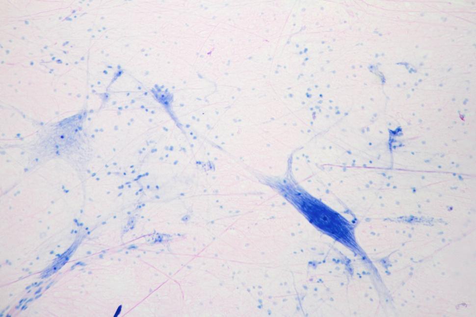 Free Image of Nerve cells 