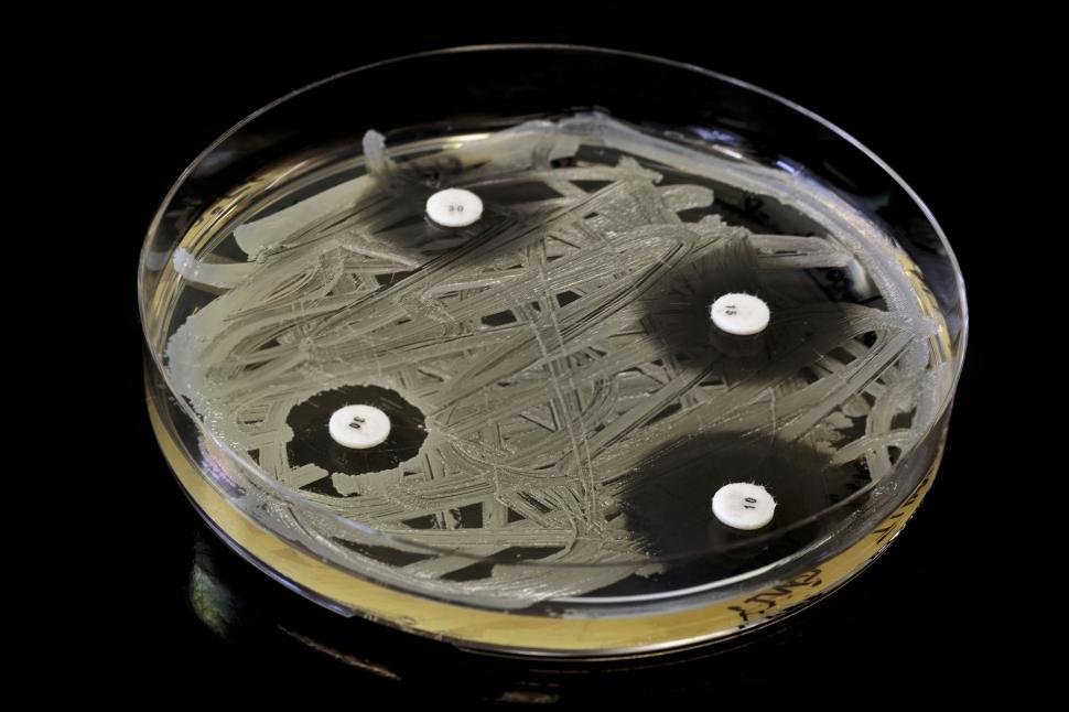 Free Image of Antibiotic testing 