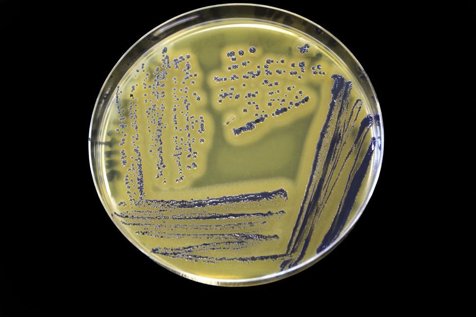 Free Image of Staphylococcus aureus 