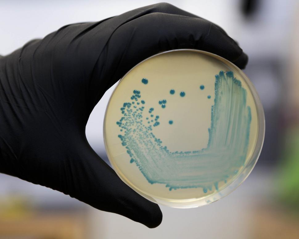 Free Image of Listeria monocytogenes  