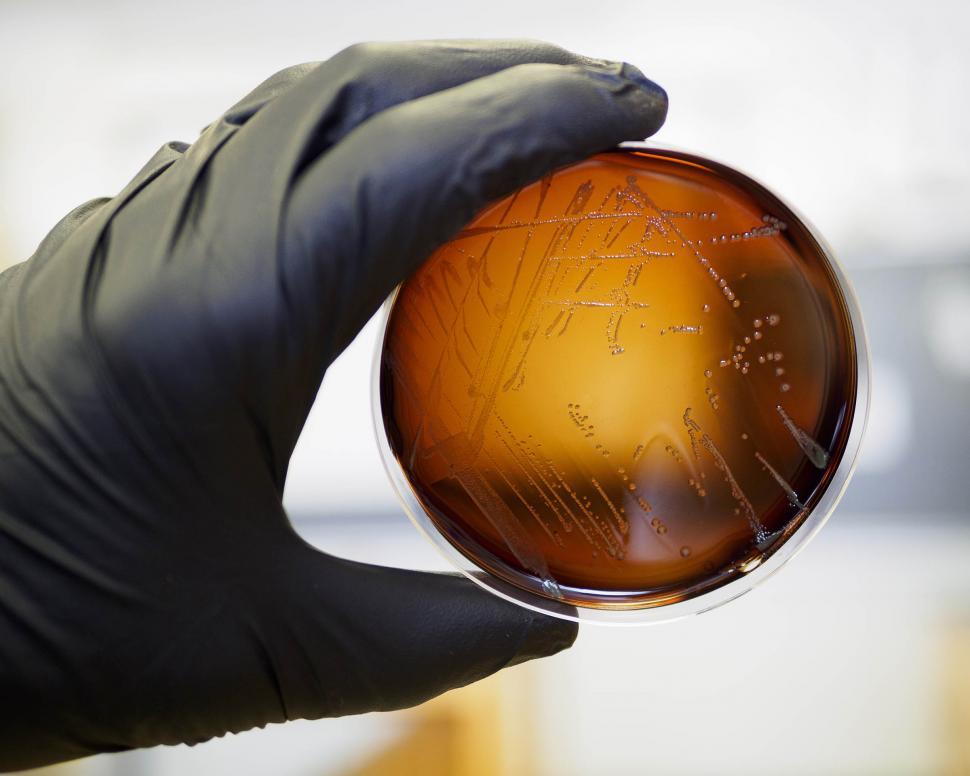 Free Image of Listeria 