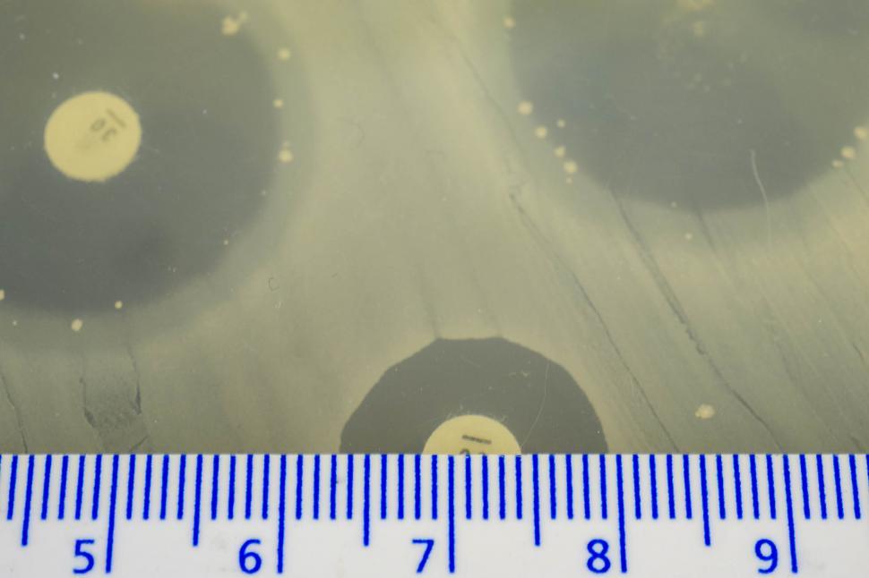 Free Image of Measuring the zone of inhibition  