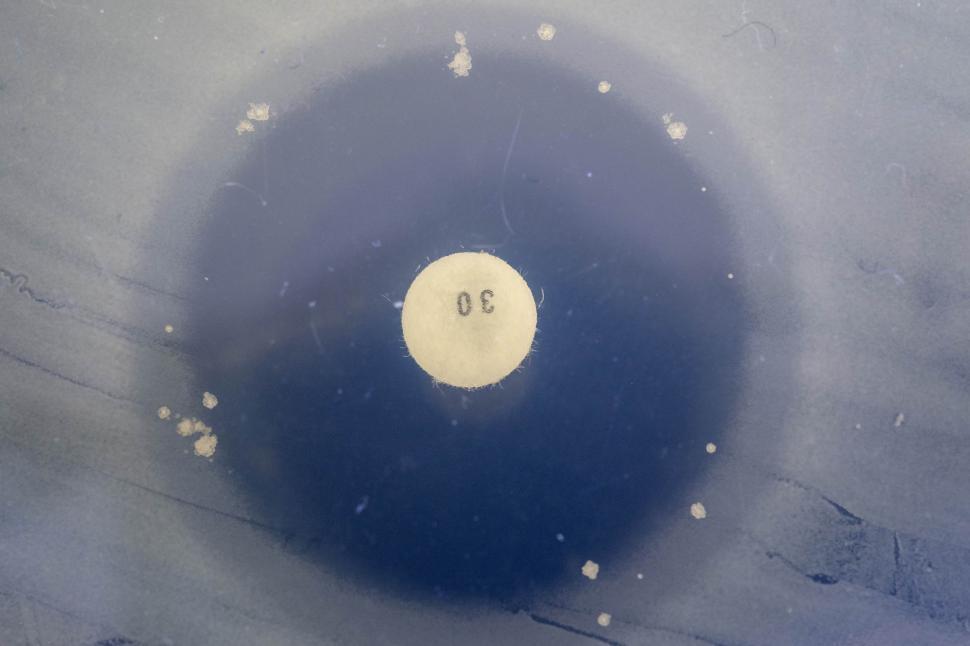 Free Image of Zone on inhibition 
