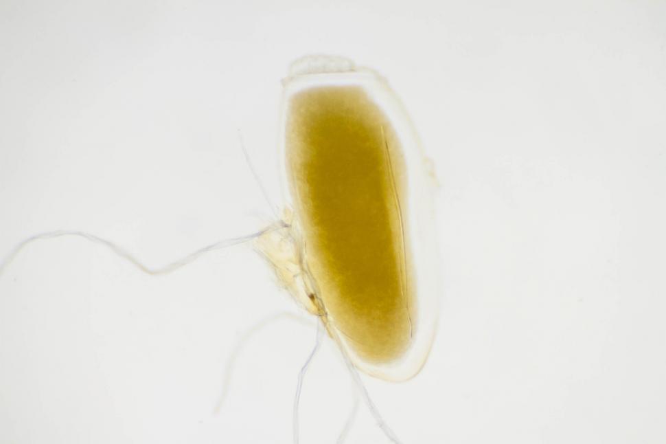 Free Image of Pediculus humanus corporis egg 