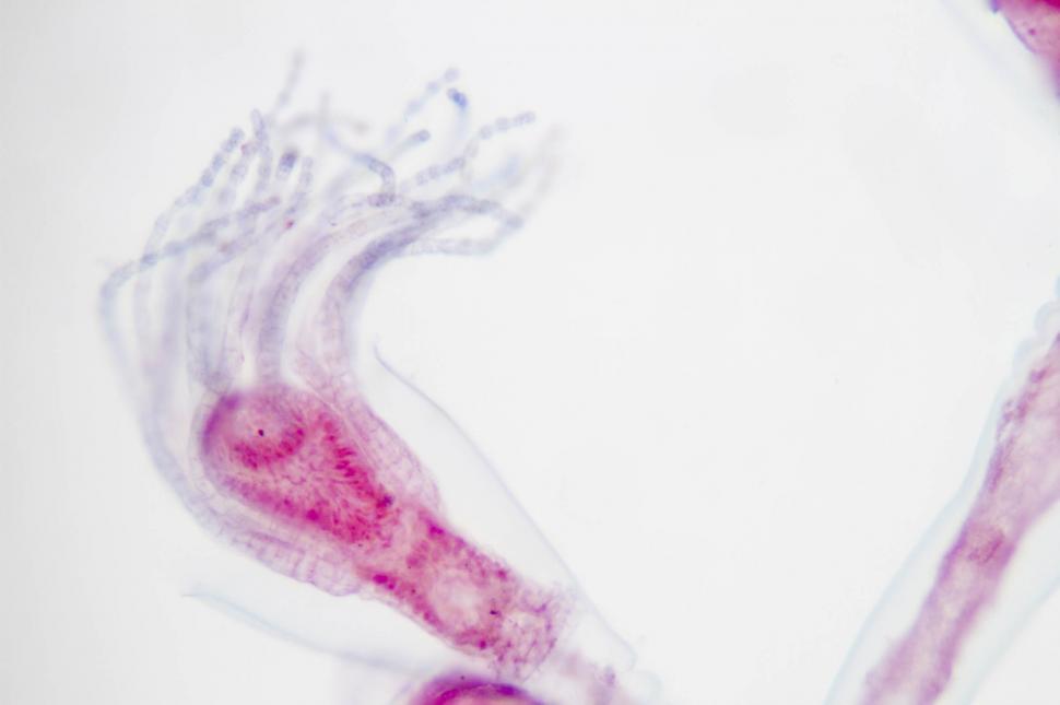 Free Image of Obelia hydroid, 100x microscope view 
