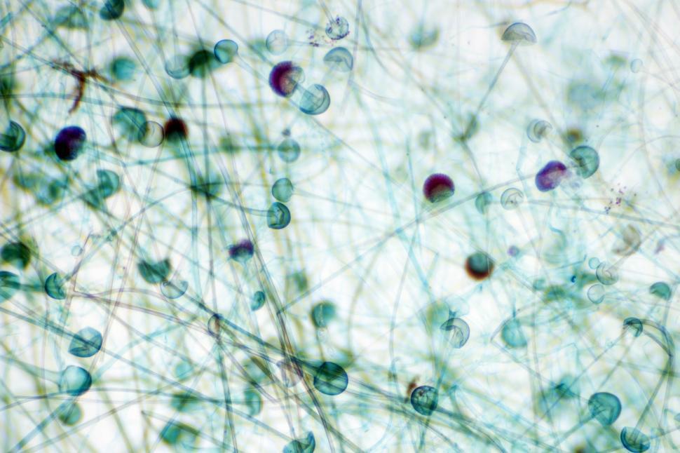 Free Image of Mold sporangium 