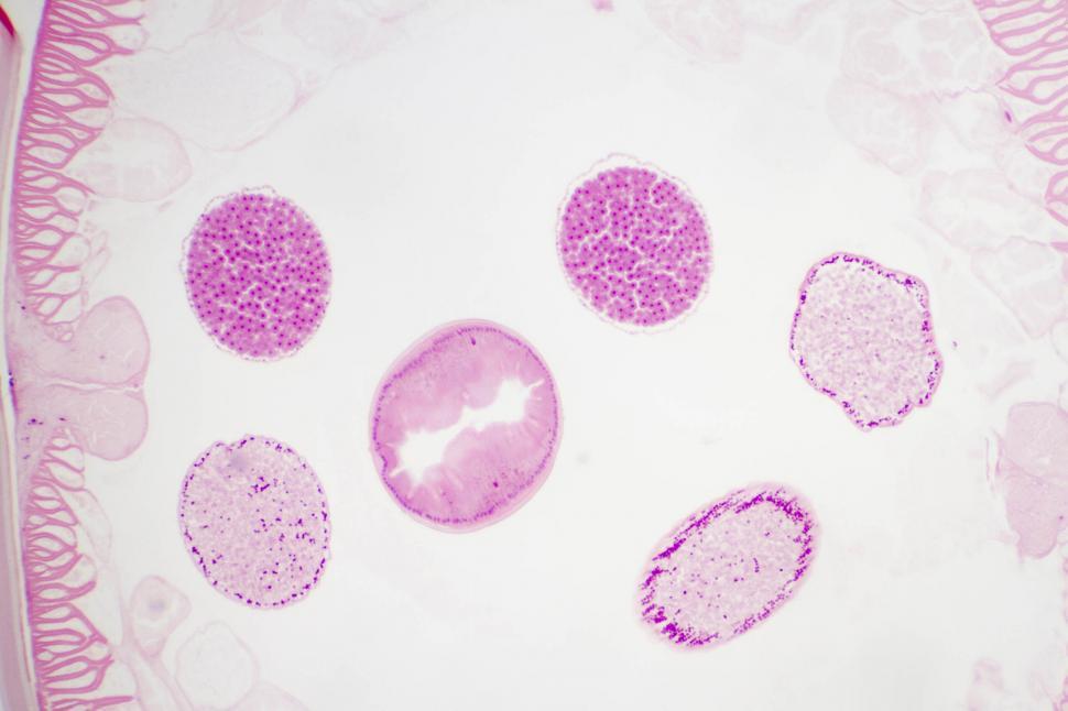 Free Image of Ascaris lumbricoides 