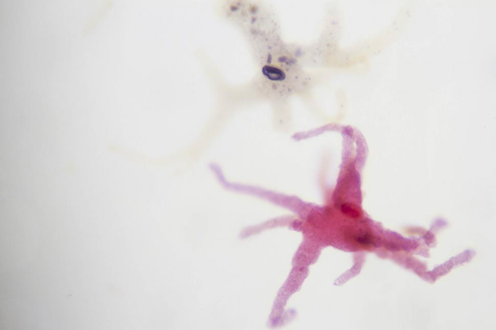 Free Image of Amoeba 