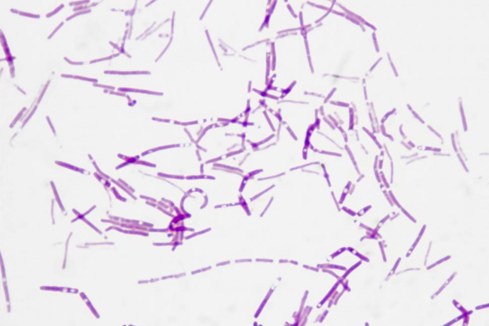 Free Image of Gram negative rods  