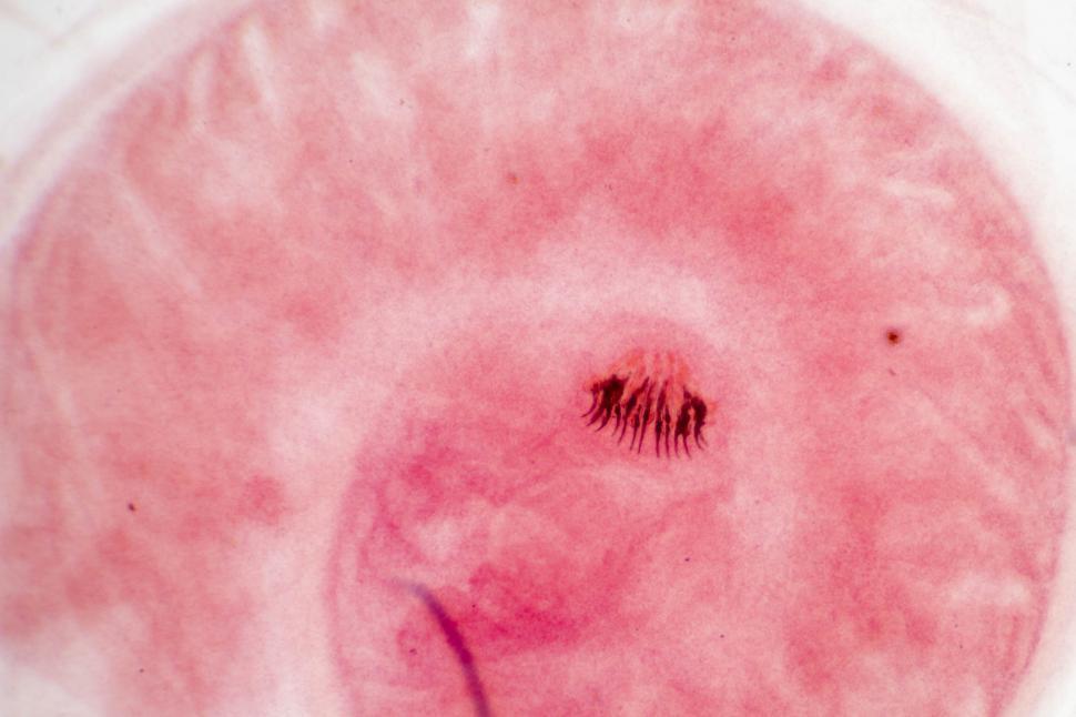 Free Image of Cysticercus 