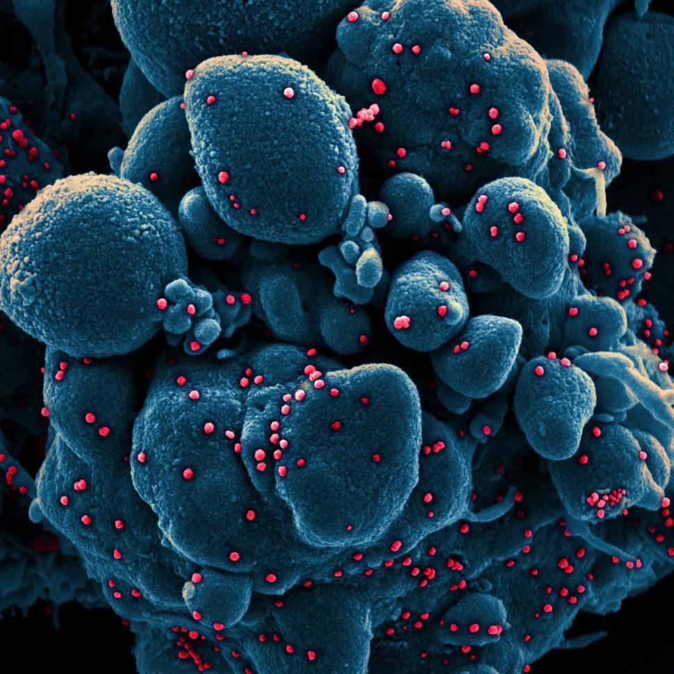 Free Image of COVID-19 Image from Electron Micrograph 