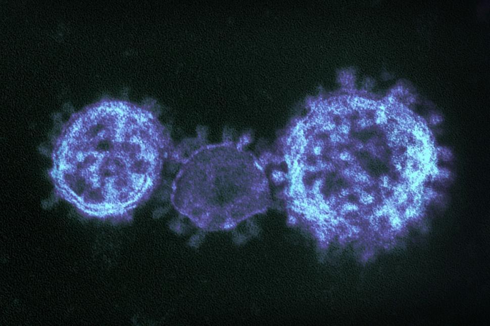 Free Image of Coronavirus Under Electron Microscope 