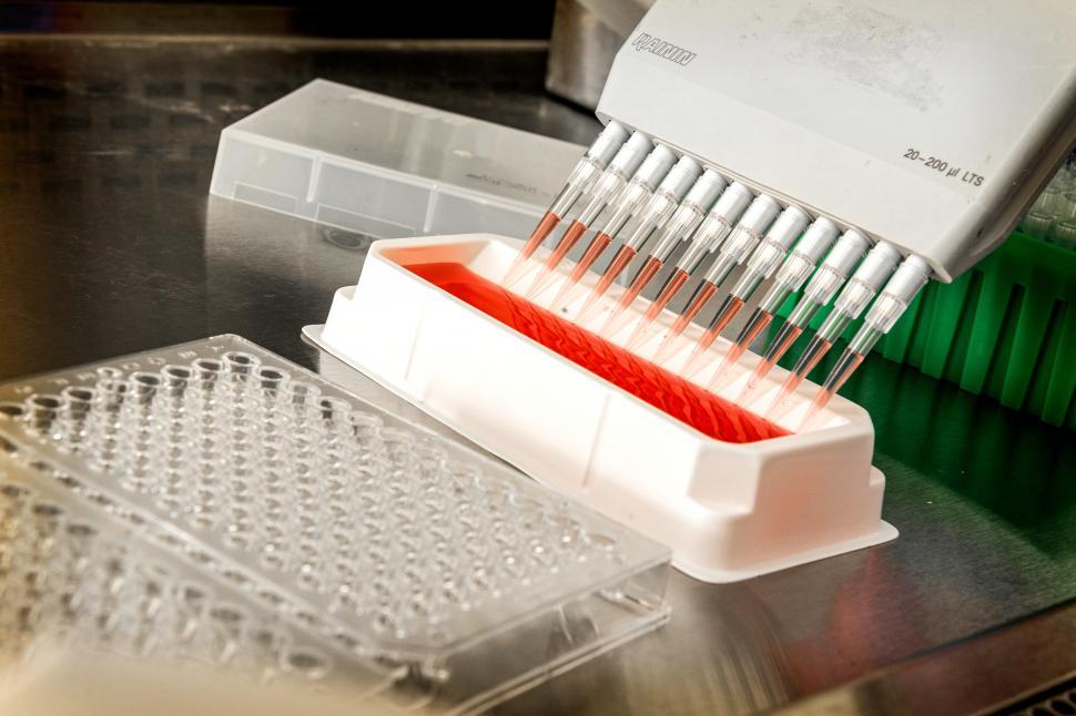 Free Image of Blood tests performed in the lab 