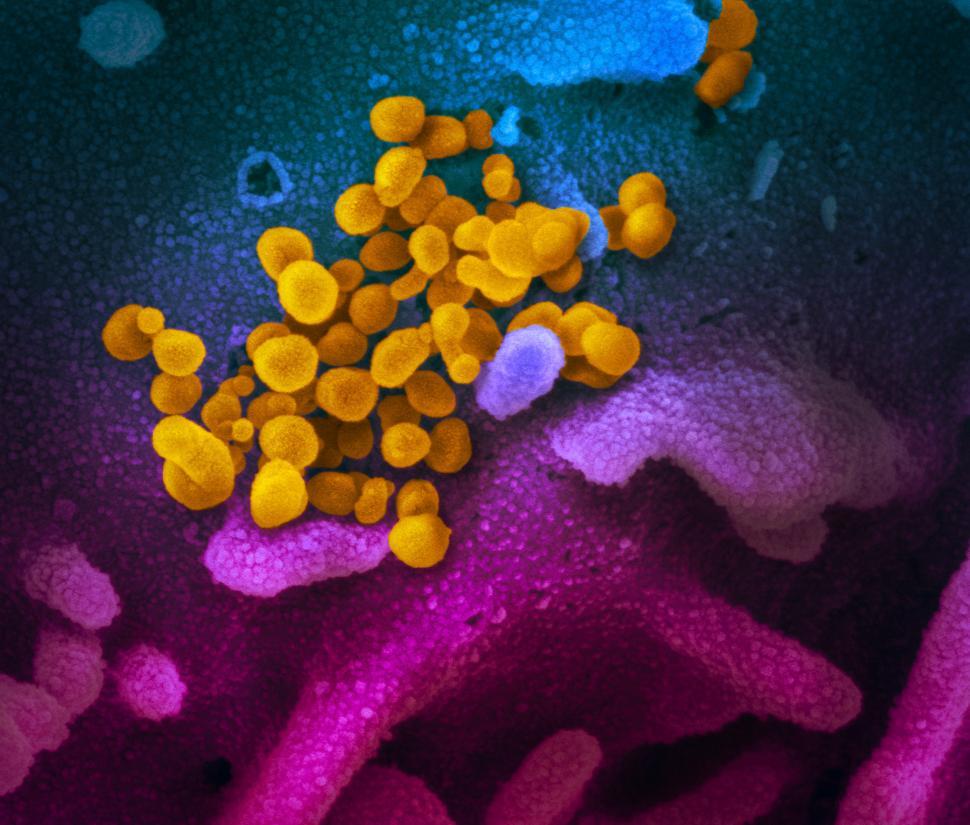 Free Image of COVID-19 virus cells that have been grown in a lab 