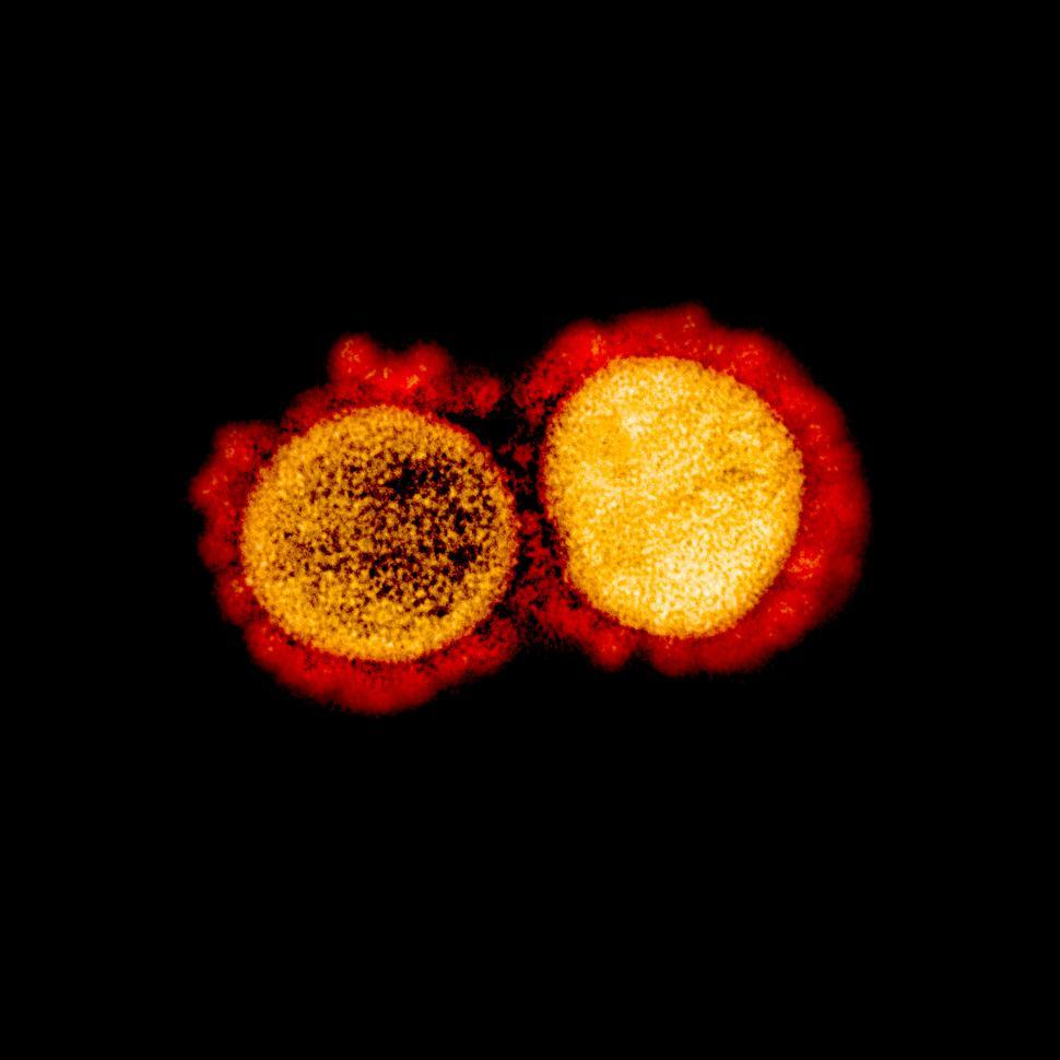 Free Image of A cluster of SARS-CoV-2 virions 