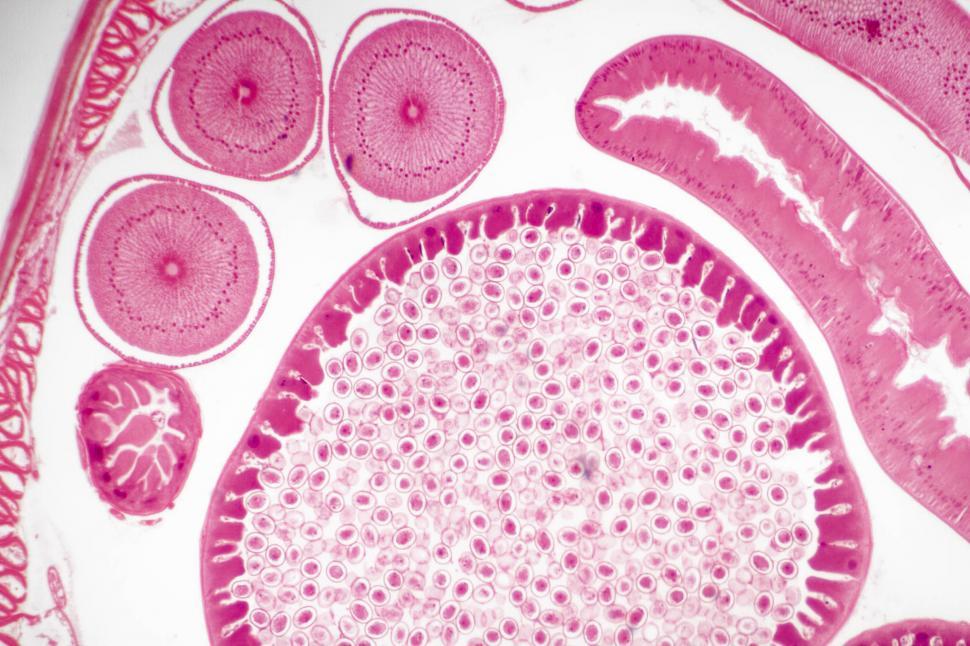 Free Image of Ascaris lumbricoides  