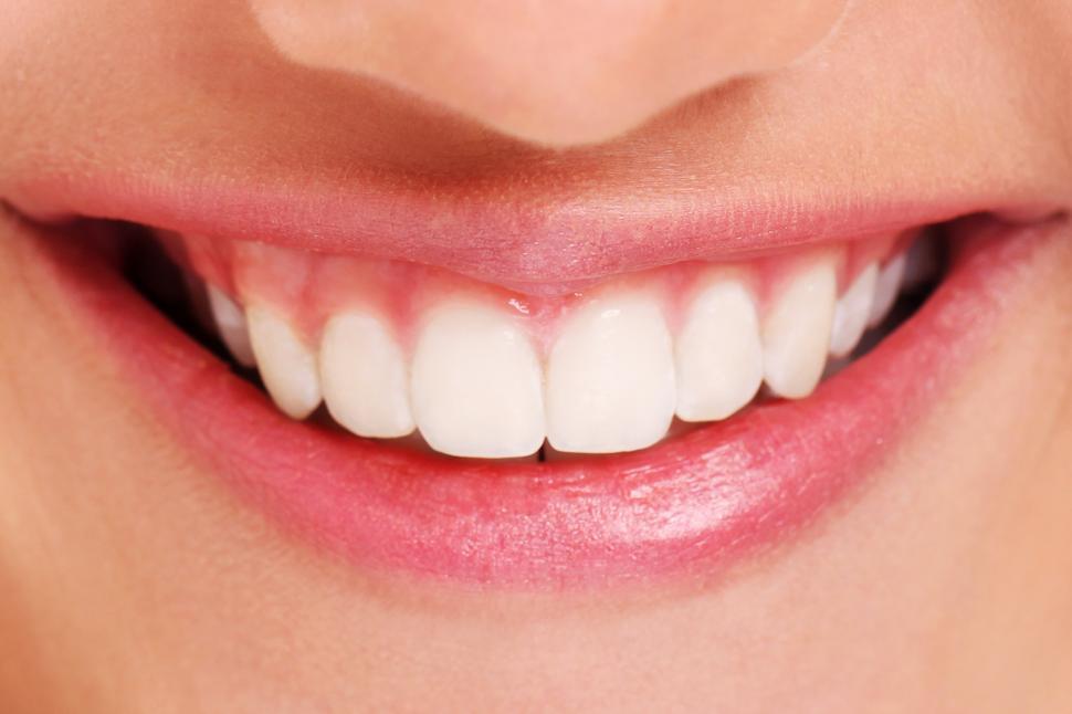 Free Image of Close of of white teeth and big smile 