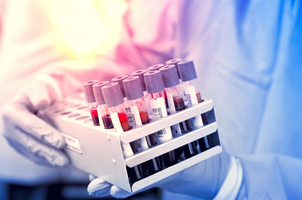 Free Image of Blood Samples - Blood Tests - Medical Tests 