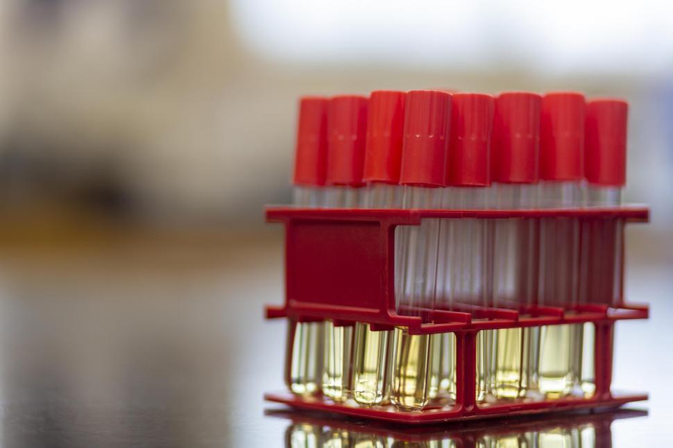 Free Image of Test tubes cantaining media 