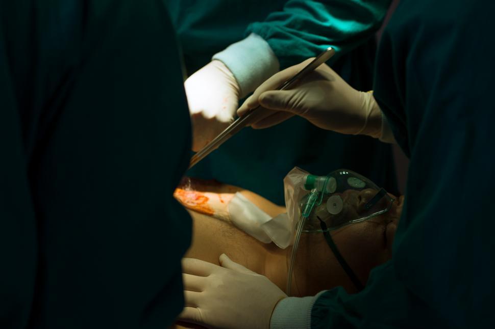 Free Image of Doctors perform surgery 