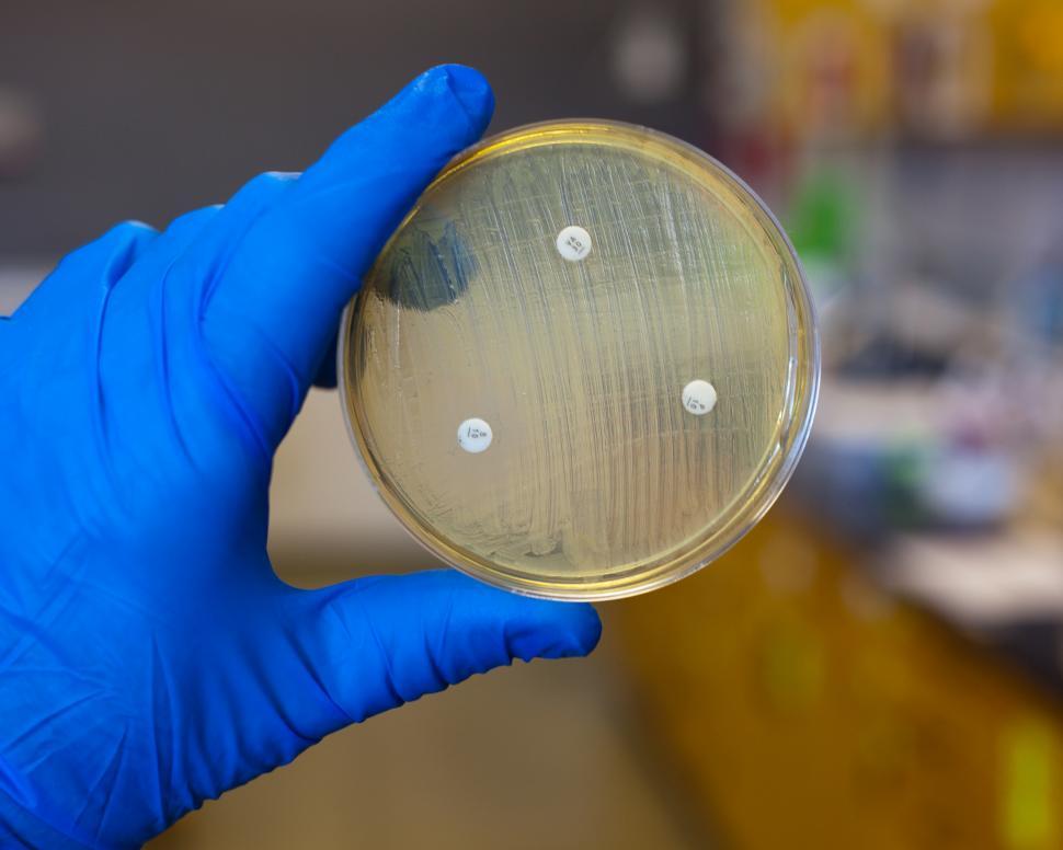 Free Image of Antibiotic resistances 