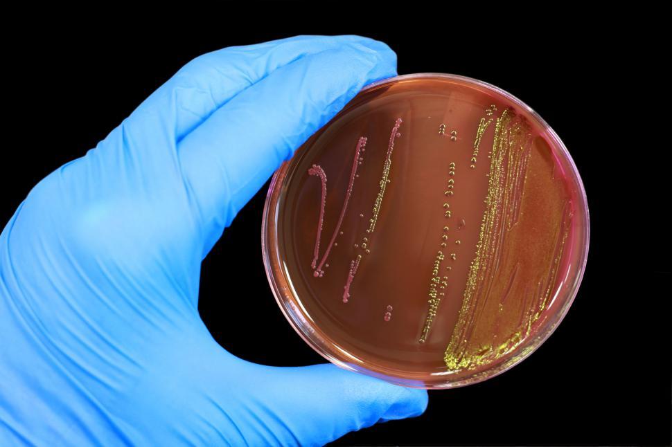 Free Image of Escherichia coli 