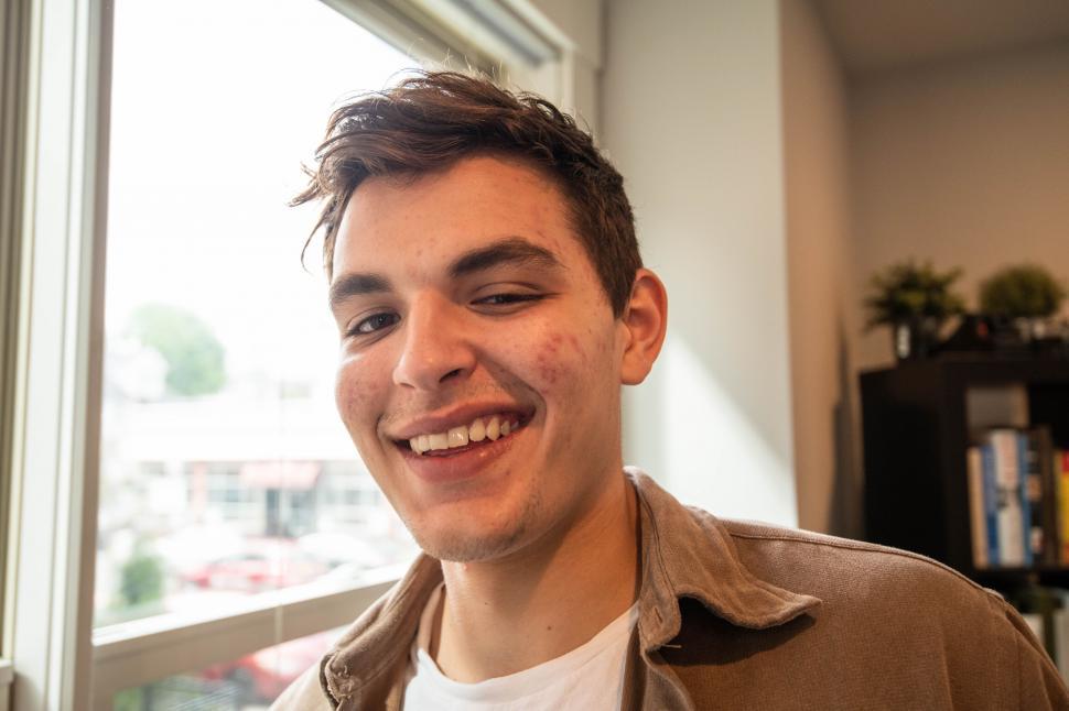 Free Image of Close-up of cheerful young man with freckles 