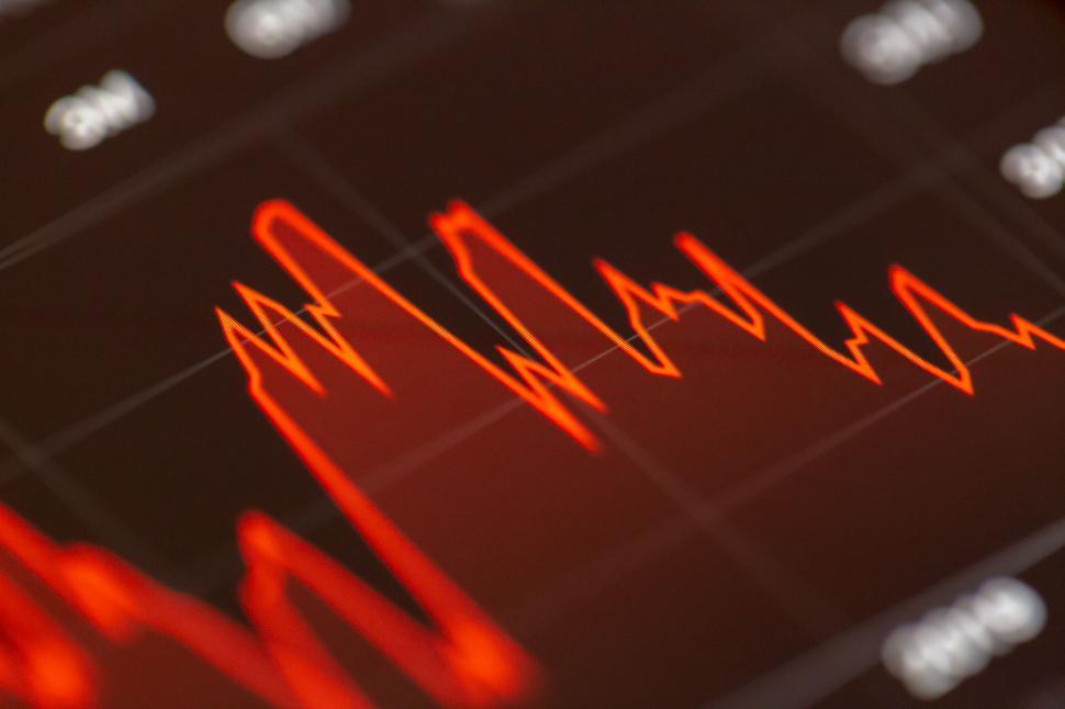 Free Image of Blurred heart rate graph on tablet 
