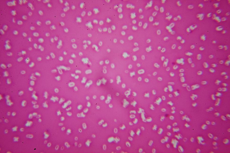 Free Image of Klebsiella pneumoniae capsule stain  