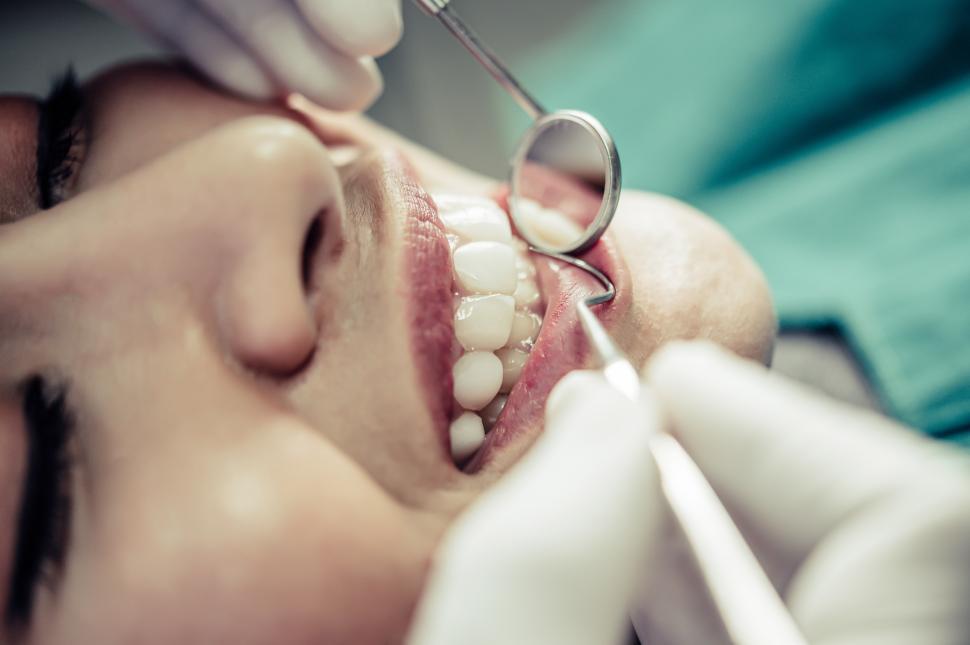 Free Image of Dental exam 
