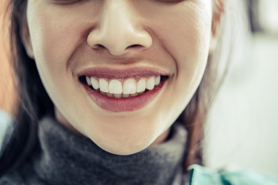 Free Image of Teeth in a healthy smile 