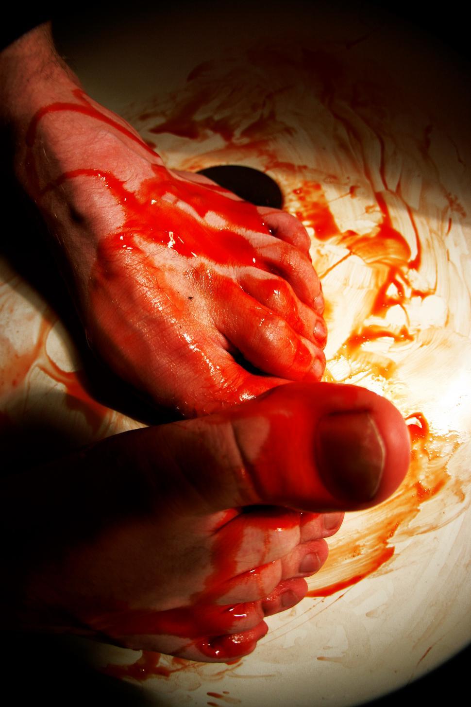 Free Image of Bloody Feet 