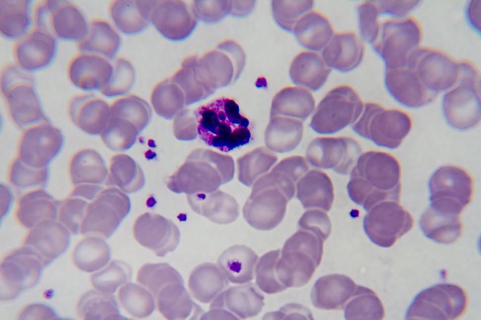 Free Image of Malaria 