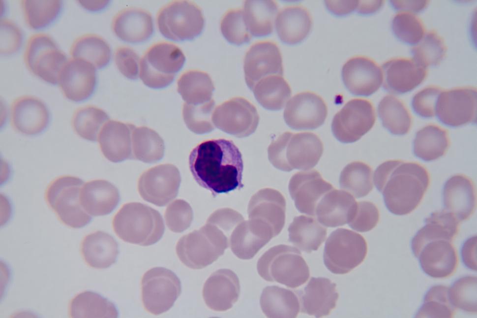 Free Image of Malaria 