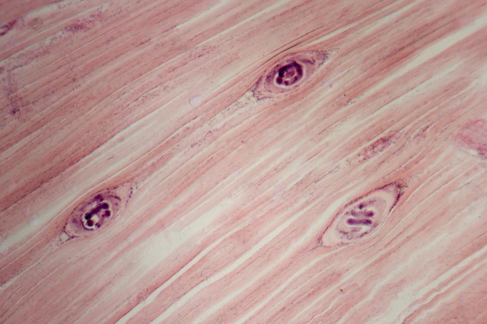 Free Image of Trichinella spiralis 