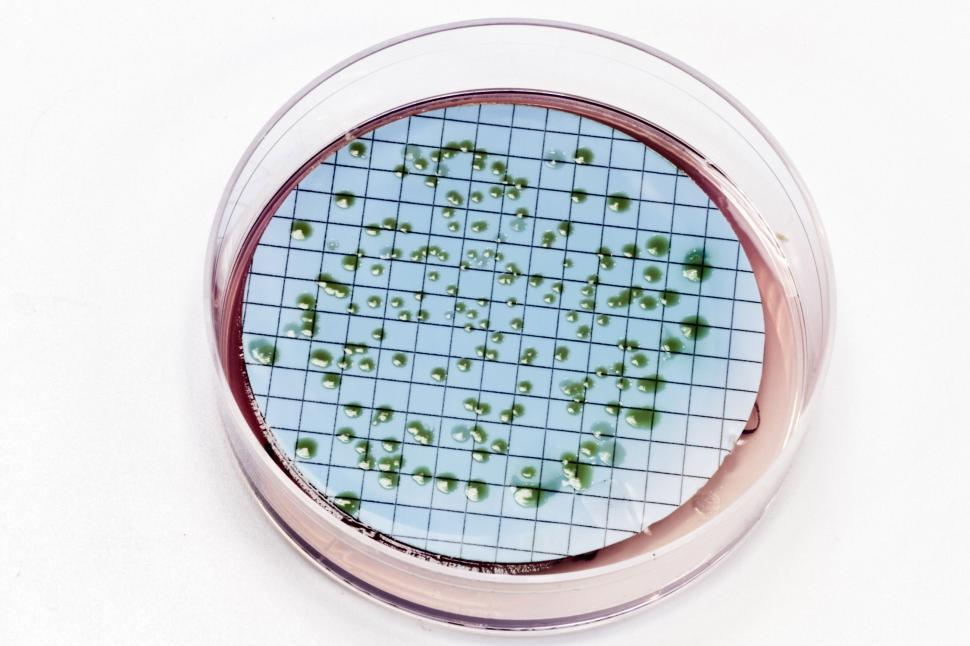 Free Image of Pseudomonas bacteria on agar plate 