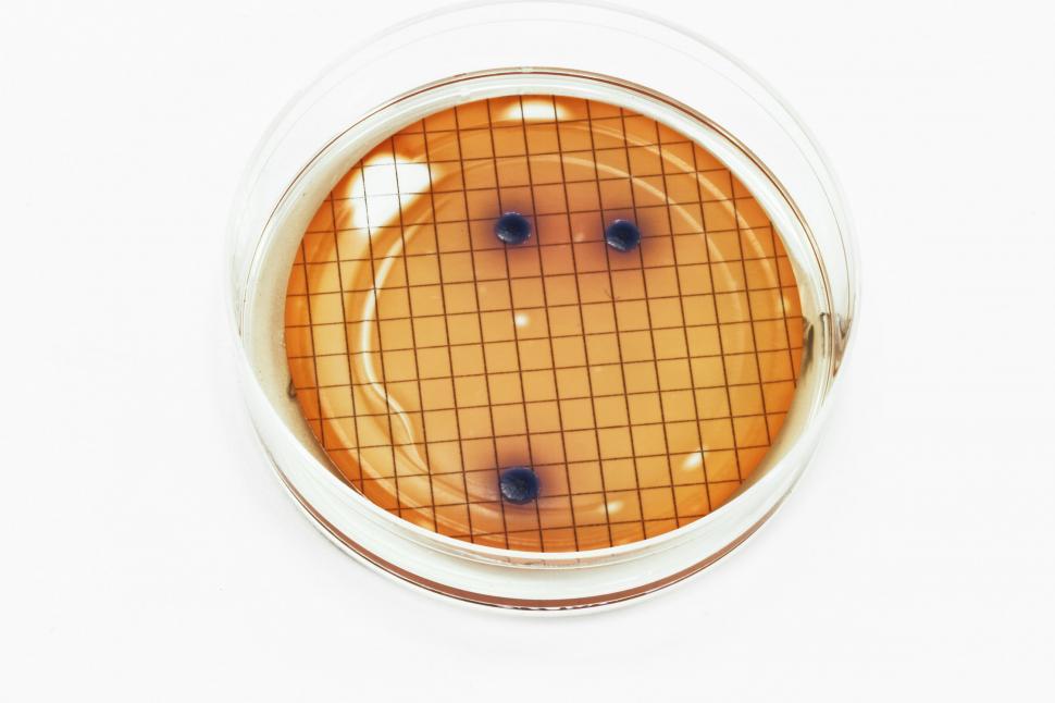 Free Image of E. coli bacteria 