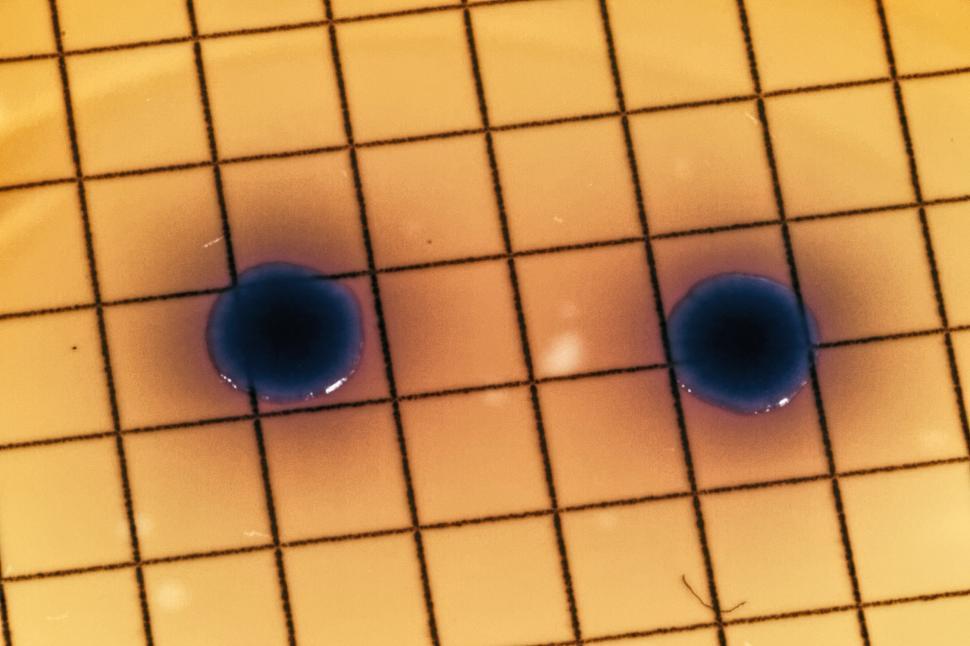 Free Image of Marco of E. coli colonies 