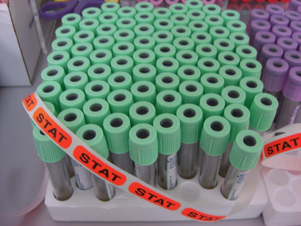 Free Image of Blood Draw Tubes 