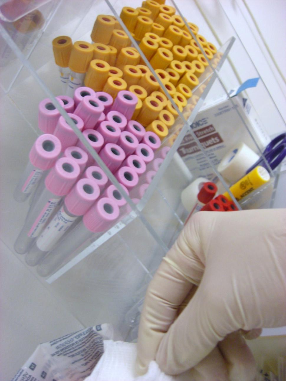 Free Image of Blood Draw Tubes 