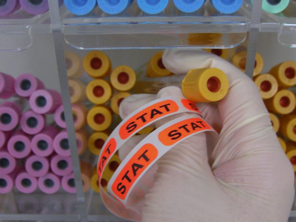 Free Image of Hand with Blood Draw Tubes 