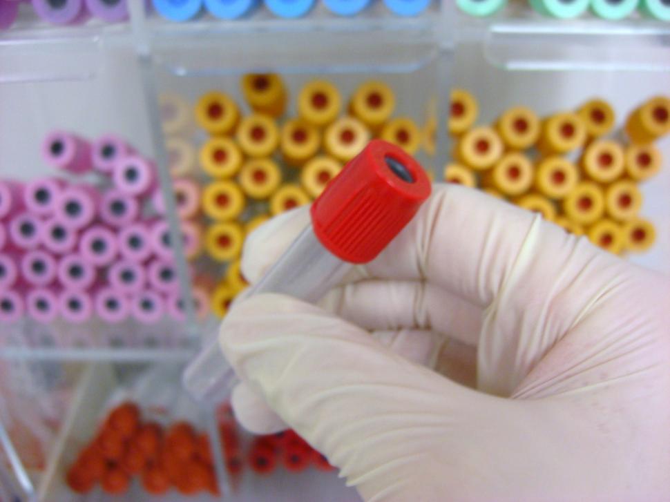 Free Image of Hand Holding Blood Draw Tube 