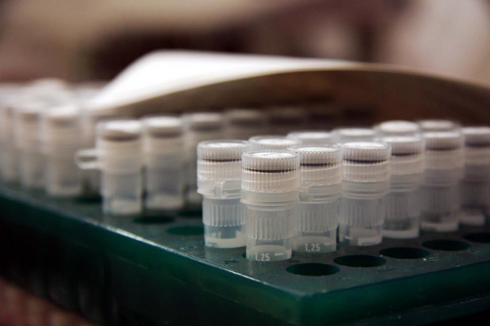 Free Image of DNA samples 