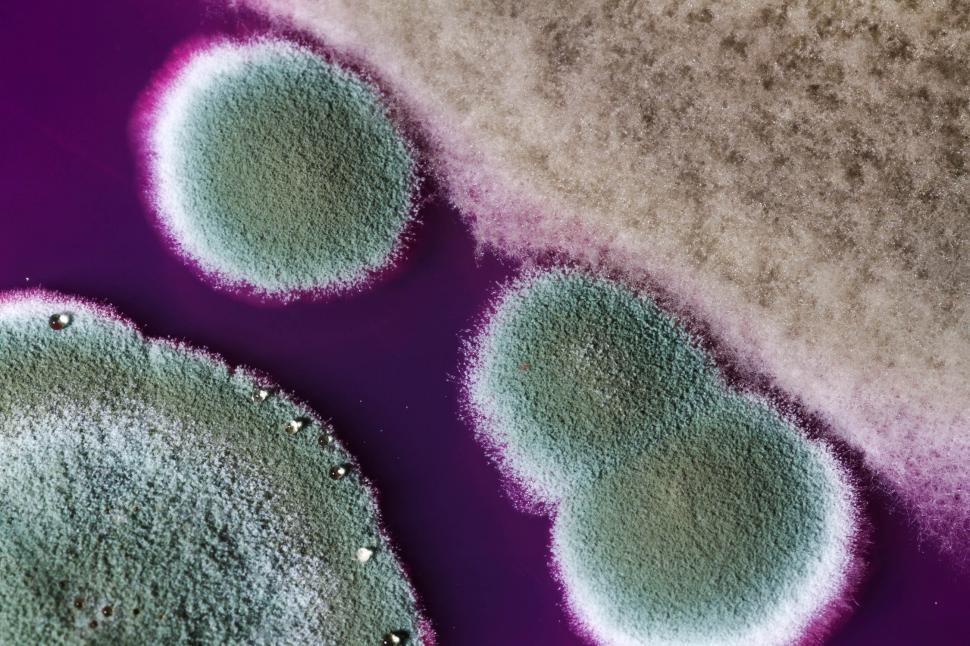 Free Image of Green mold on a petri plate 