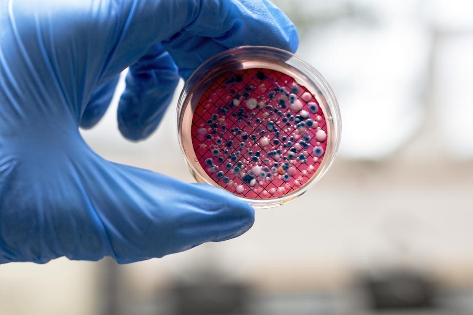 Free Image of Hand holding an agar plate containing Escherichia coli 