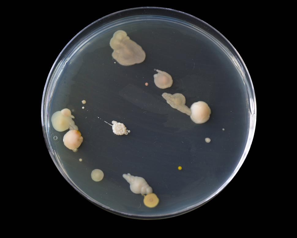 Free Image of Bacteria on an agar plate 